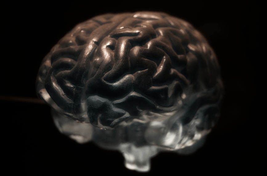 A human brain